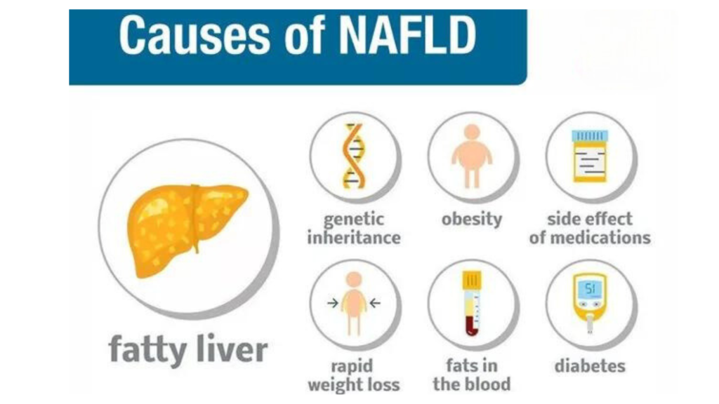 Causes of Fatty Liver Disease