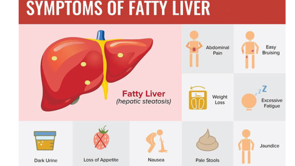 Symptoms of Fatty Liver