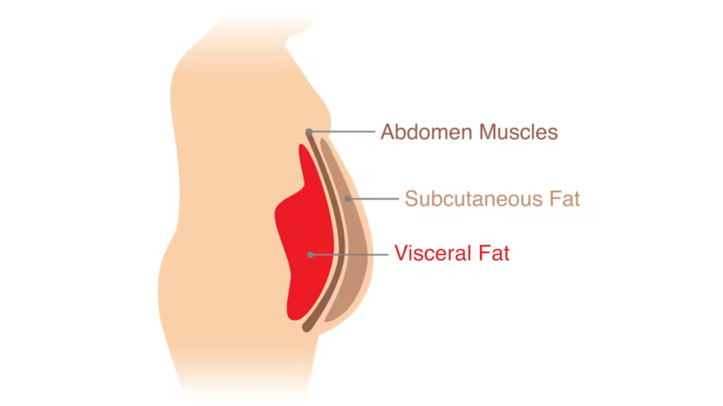 Type of Belly Fat